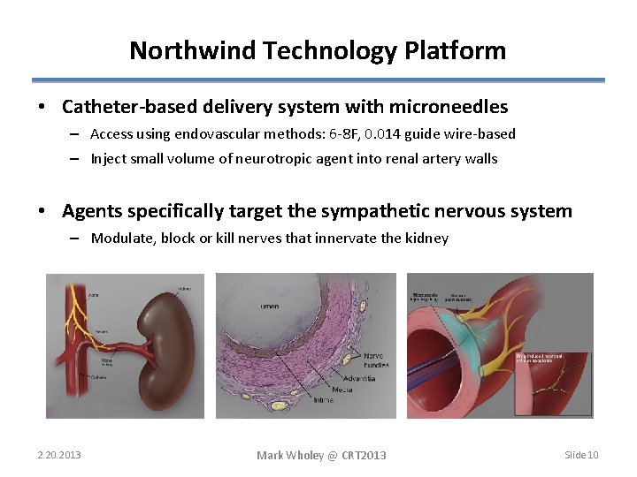 Northwind Technology Platform • Catheter-based delivery system with microneedles – Access using endovascular methods: