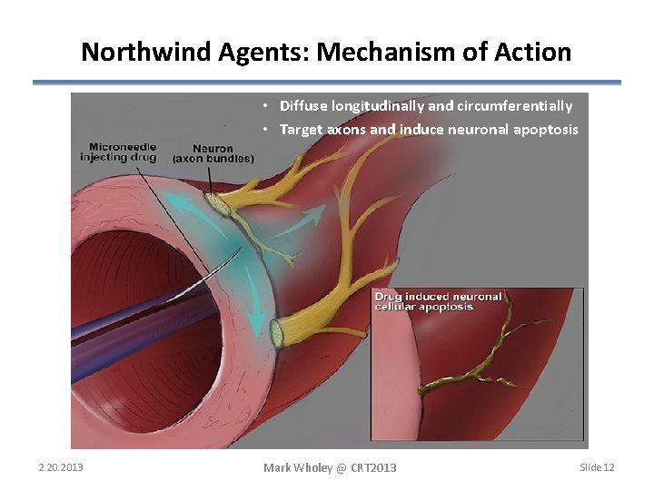 Northwind Agents: Mechanism of Action • Diffuse longitudinally and circumferentially • Target axons and