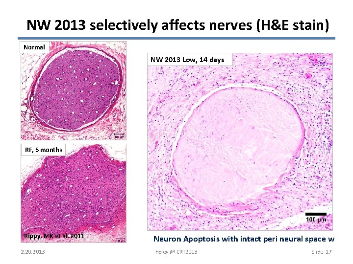 NW 2013 selectively affects nerves (H&E stain) Normal NW 2013 Low, 14 days RF,