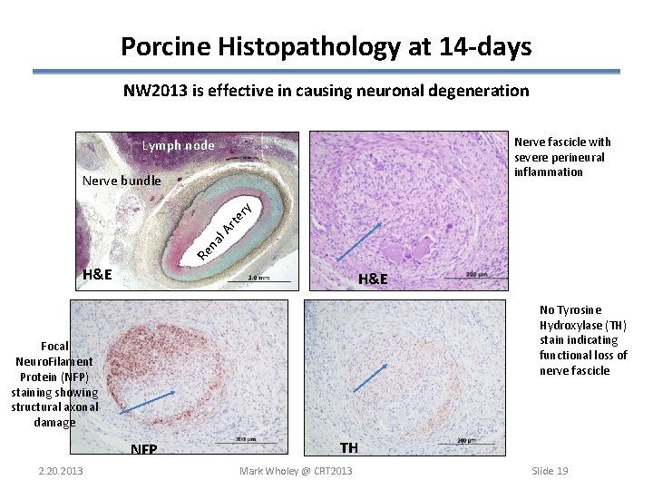 Porcine Histopathology at 14 -days NW 2013 is effective in causing neuronal degeneration Nerve