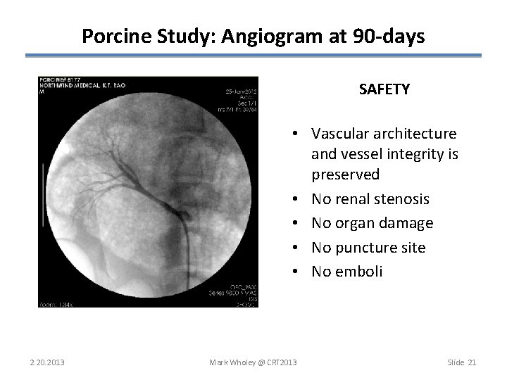 Porcine Study: Angiogram at 90 -days SAFETY • Vascular architecture and vessel integrity is