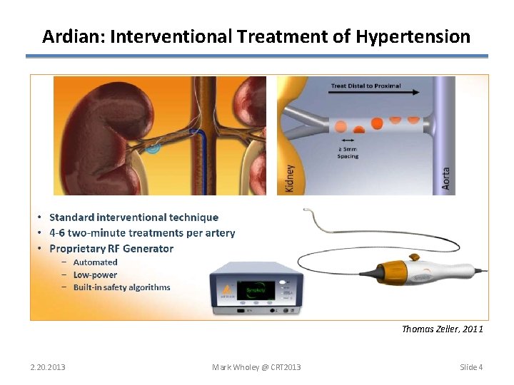 Ardian: Interventional Treatment of Hypertension Thomas Zeller, 2011 2. 2013 Mark Wholey @ CRT