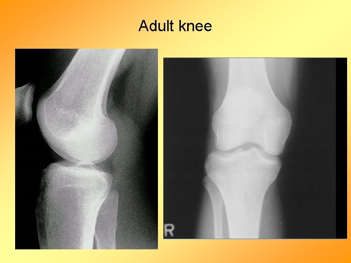 Adult knee 