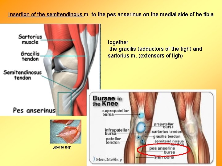 Insertion of the semitendinous m. to the pes anserinus on the medial side of