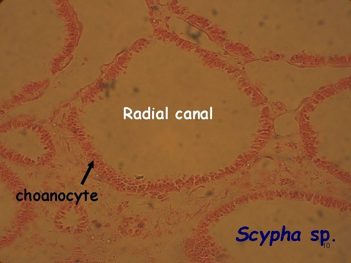 Radial canal choanocyte Scypha sp. 10 