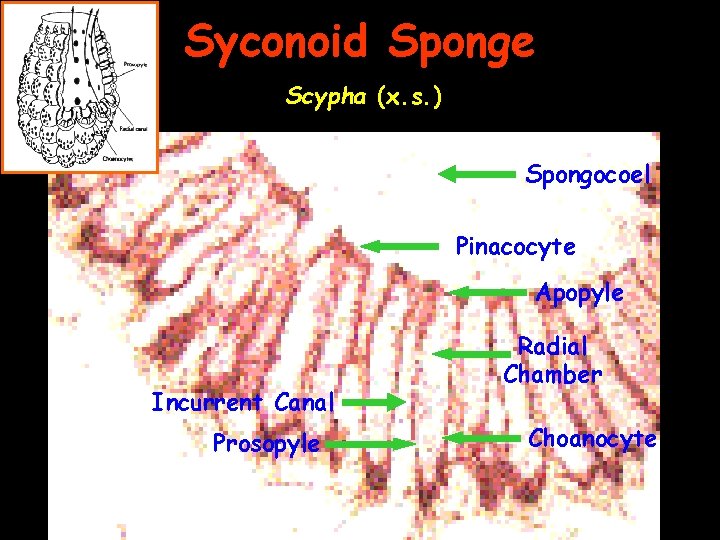 Syconoid Sponge Scypha (x. s. ) Spongocoel Pinacocyte Apopyle Incurrent Canal Prosopyle Radial Chamber