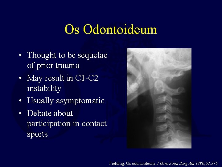 Os Odontoideum • Thought to be sequelae of prior trauma • May result in