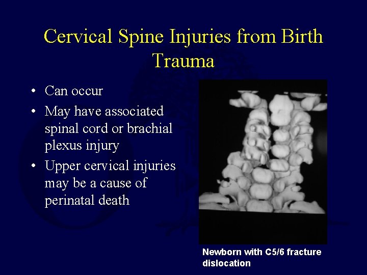 Cervical Spine Injuries from Birth Trauma • Can occur • May have associated spinal