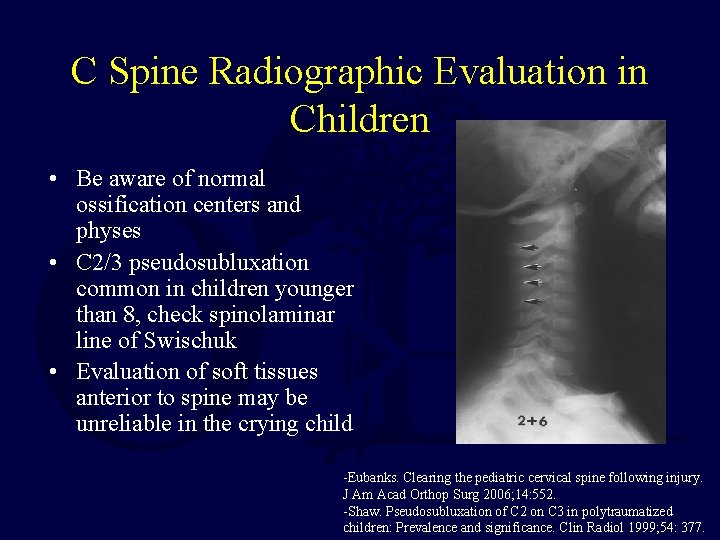 C Spine Radiographic Evaluation in Children • Be aware of normal ossification centers and