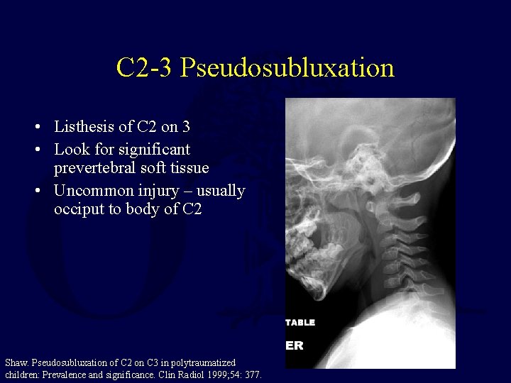 C 2 -3 Pseudosubluxation • Listhesis of C 2 on 3 • Look for