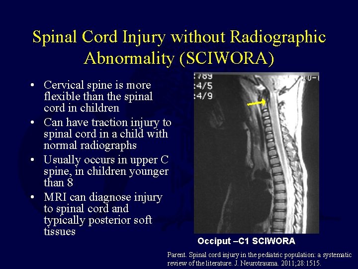 Spinal Cord Injury without Radiographic Abnormality (SCIWORA) • Cervical spine is more flexible than