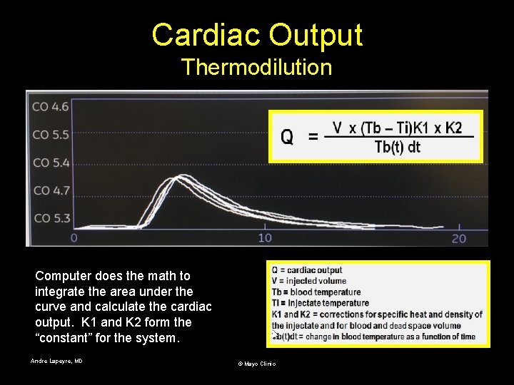 Cardiac Output Thermodilution Computer does the math to integrate the area under the curve