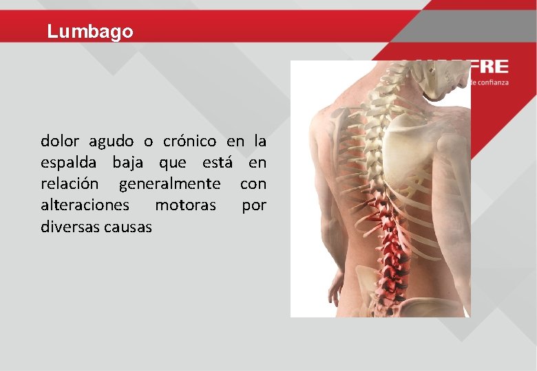 Lumbago dolor agudo o crónico en la espalda baja que está en relación generalmente
