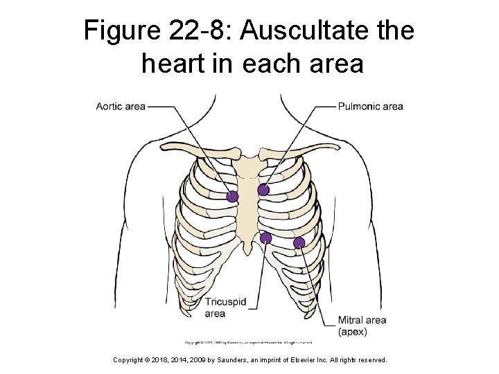 Figure 22 -8: Auscultate the heart in each area Copyright © 2018, 2014, 2009