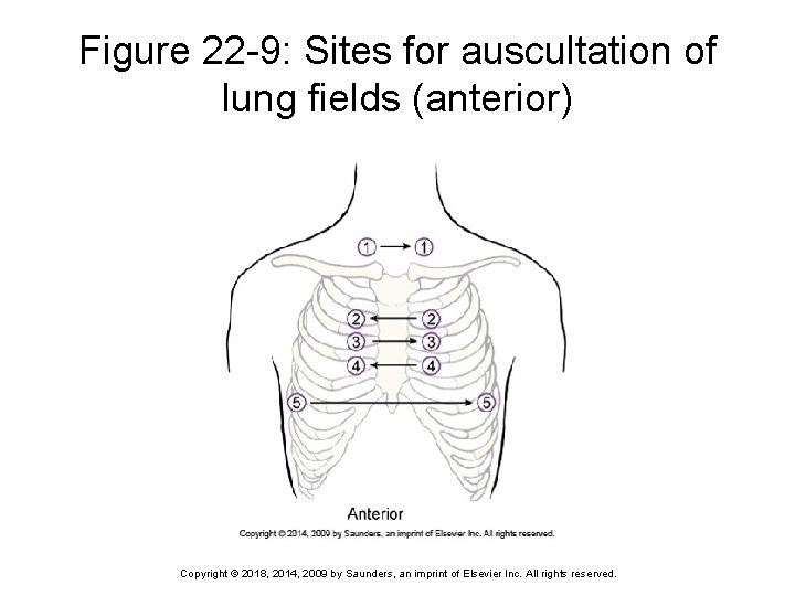 Figure 22 -9: Sites for auscultation of lung fields (anterior) Copyright © 2018, 2014,