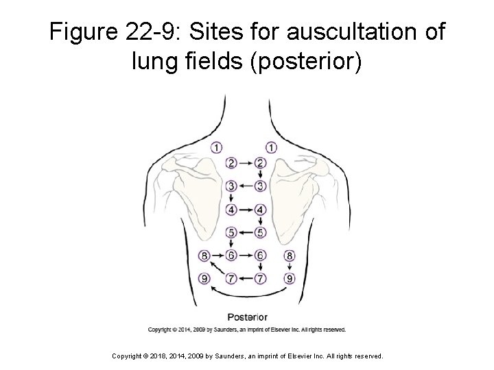 Figure 22 -9: Sites for auscultation of lung fields (posterior) Copyright © 2018, 2014, Figure 22 -9: Sites for auscultation of lung fields (posterior) Copyright © 2018, 2014,
