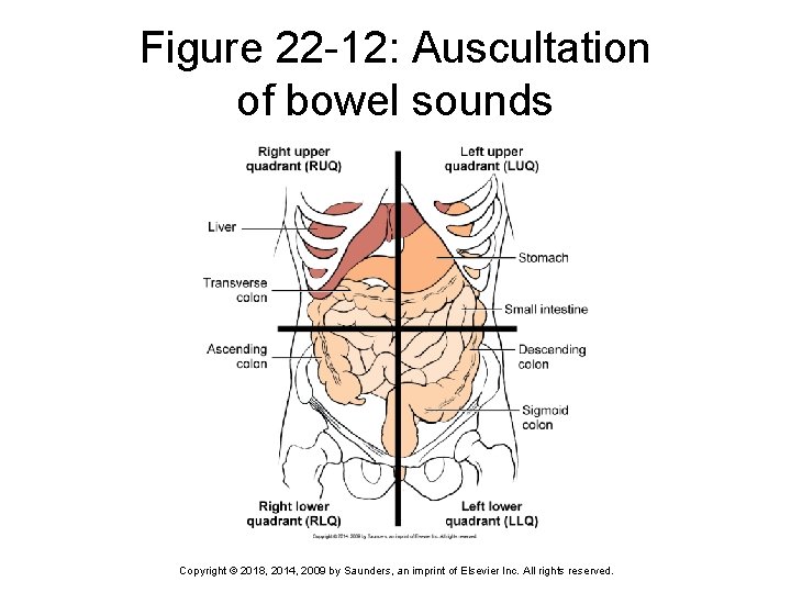 Figure 22 -12: Auscultation of bowel sounds Copyright © 2018, 2014, 2009 by Saunders,