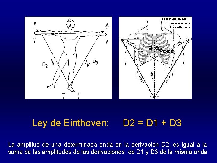 Línea medioclavicular Línea axilar anterior Línea axilar media Ley de Einthoven: D 2 =