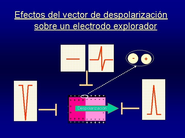 Efectos del vector de despolarización sobre un electrodo explorador - Despolarizaciòn + 