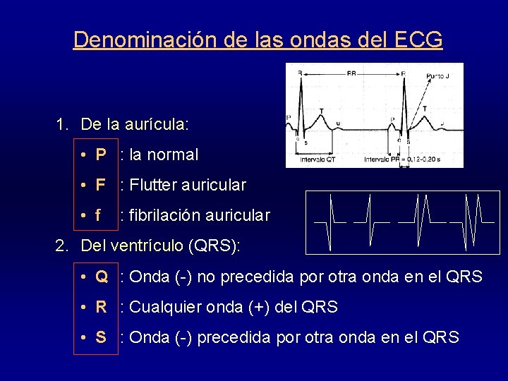 Denominación de las ondas del ECG 1. De la aurícula: • P : la