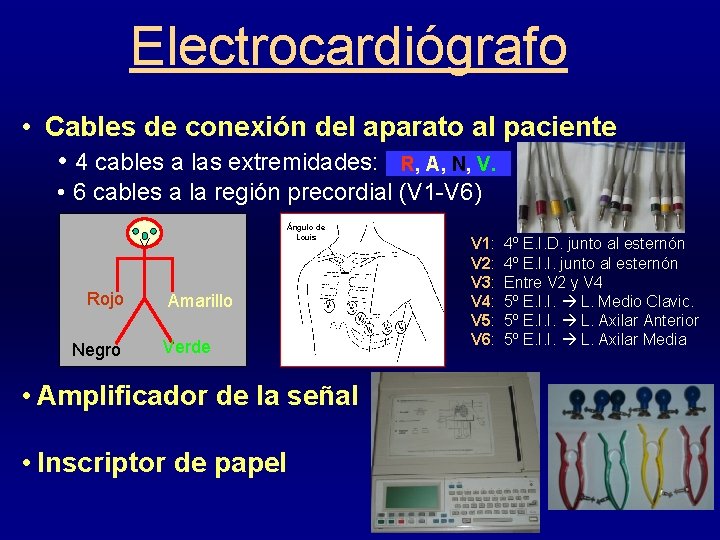 Electrocardiógrafo • Cables de conexión del aparato al paciente • 4 cables a las