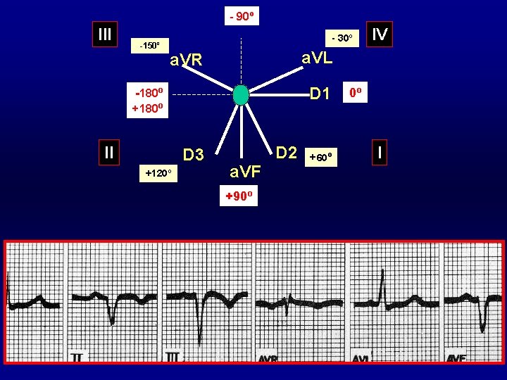 - 90º III -150º - 30º a. VL a. VR D 1 -180º +180º