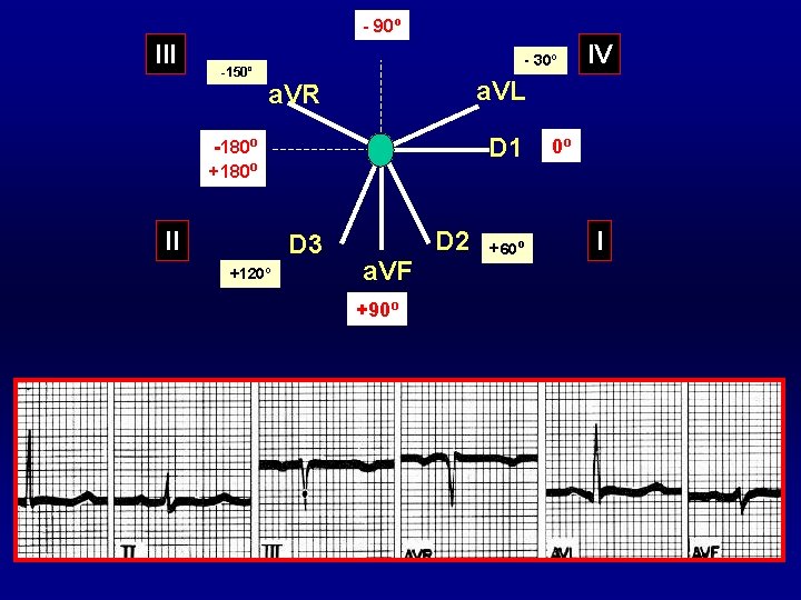 - 90º III -150º - 30º a. VL a. VR D 1 -180º +180º