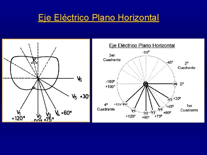 Eje Eléctrico Plano Horizontal 