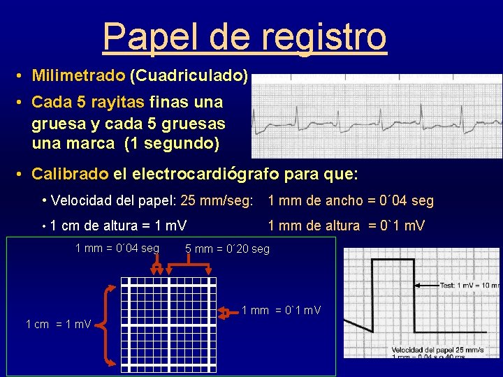 Papel de registro • Milimetrado (Cuadriculado) • Cada 5 rayitas finas una gruesa y