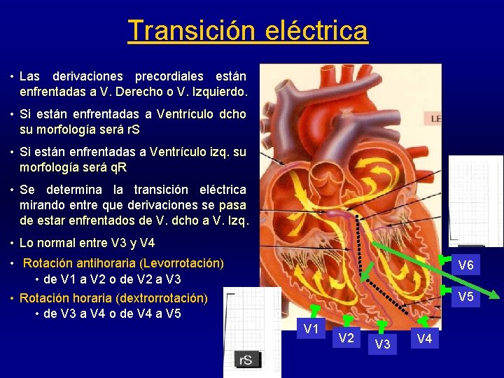 Transición eléctrica • Las derivaciones precordiales están enfrentadas a V. Derecho o V. Izquierdo.