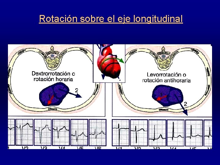 Rotación sobre el eje longitudinal 