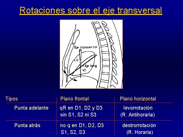 Rotaciones sobre el eje transversal Tipos Plano frontal Plano horizontal Punta adelante q. R