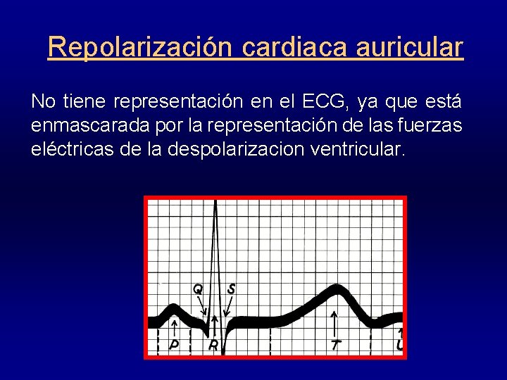 Repolarización cardiaca auricular No tiene representación en el ECG, ya que está enmascarada por