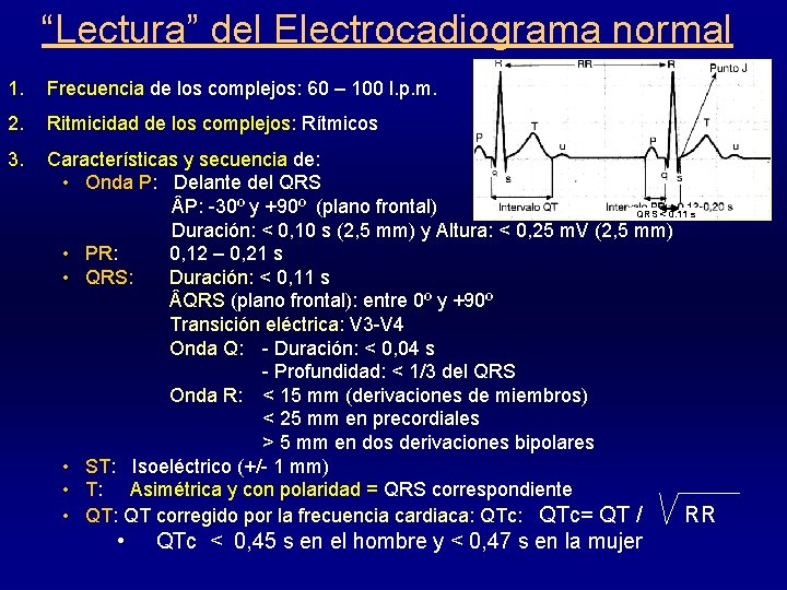 “Lectura” del Electrocadiograma normal 1. Frecuencia de los complejos: 60 – 100 l. p.