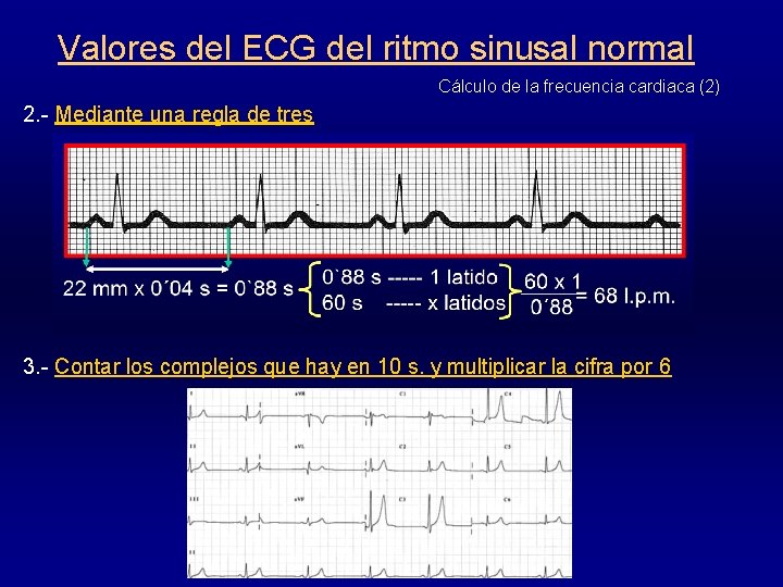 Valores del ECG del ritmo sinusal normal Cálculo de la frecuencia cardiaca (2) 2.