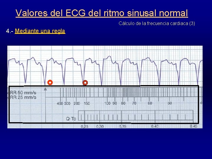 Valores del ECG del ritmo sinusal normal Cálculo de la frecuencia cardiaca (3) 4.