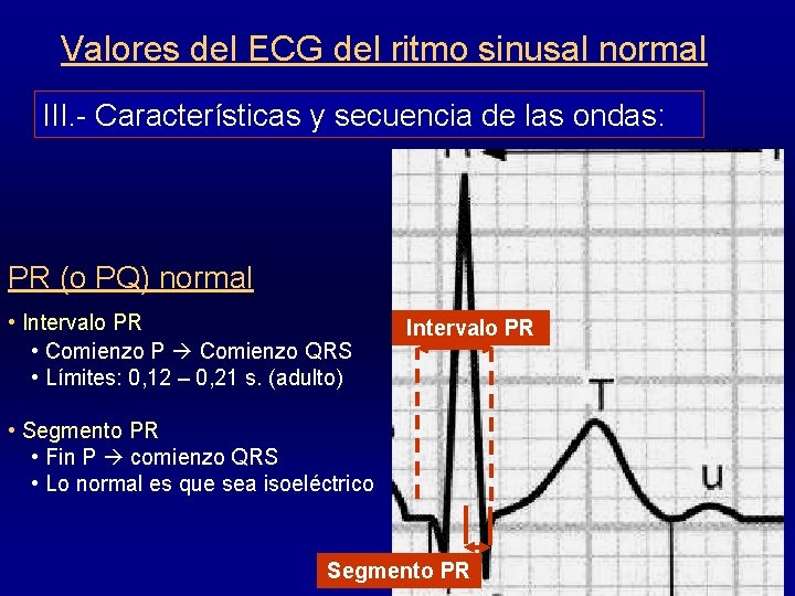 Valores del ECG del ritmo sinusal normal III. - Características y secuencia de las