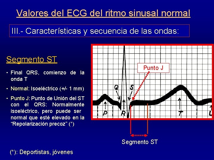 Valores del ECG del ritmo sinusal normal III. - Características y secuencia de las