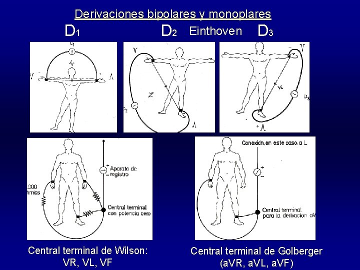 Derivaciones bipolares y monoplares D 1 D 2 Einthoven D 3 Central terminal de