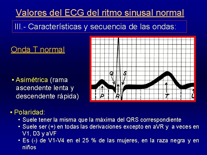 Valores del ECG del ritmo sinusal normal III. - Características y secuencia de las