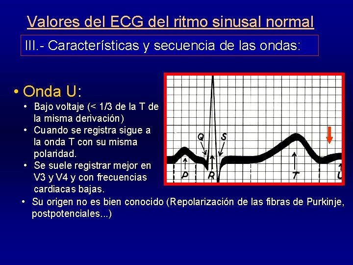 Valores del ECG del ritmo sinusal normal III. - Características y secuencia de las