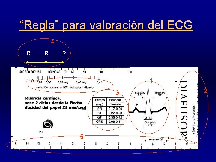 “Regla” para valoración del ECG 4 R R R 1 3 5 2 