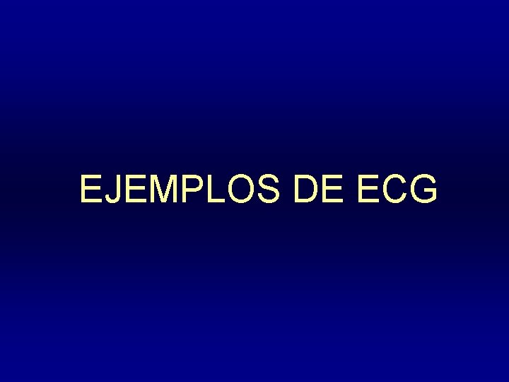 EJEMPLOS DE ECG 