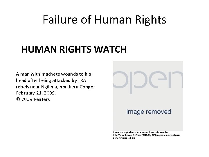 Failure of Human Rights HUMAN RIGHTS WATCH A man with machete wounds to his