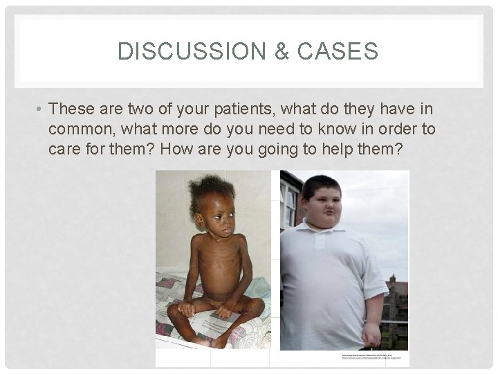 DISCUSSION & CASES • These are two of your patients, what do they have