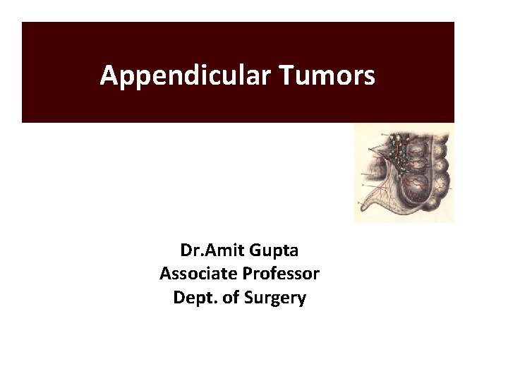 Appendicular Tumors Dr. Amit Gupta Associate Professor Dept. of Surgery 