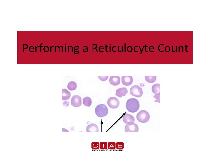 Performing a Reticulocyte Count 