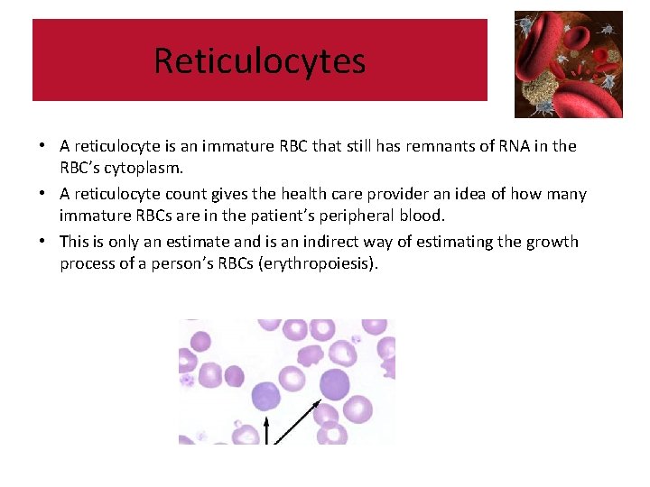Reticulocytes • A reticulocyte is an immature RBC that still has remnants of RNA