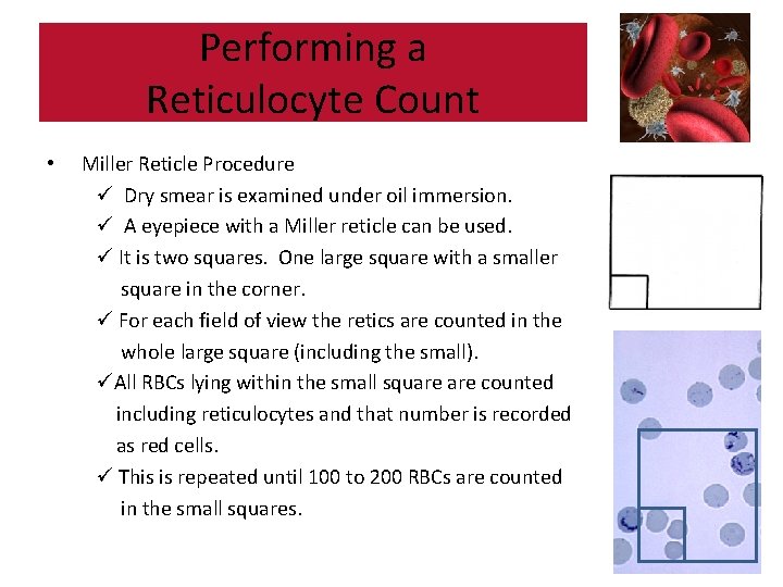 Performing a Reticulocyte Count • Miller Reticle Procedure ü Dry smear is examined under