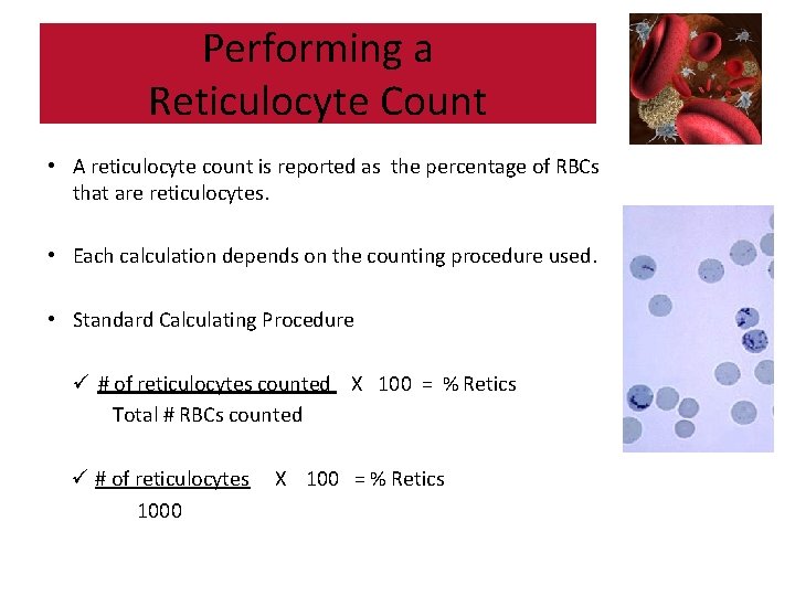 Performing a Reticulocyte Count • A reticulocyte count is reported as the percentage of